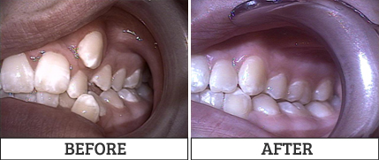 dental transformation by Wahroonga Dental