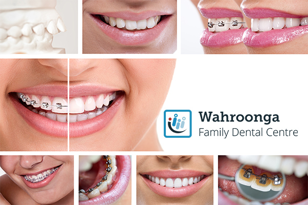 Which orthodontic treatment is right for me?