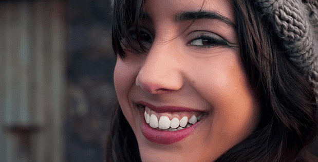 Correction of severe overbite and gummy smile in patients with